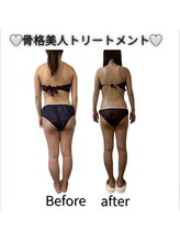 フォルスボーテ(Force Beaute)/【骨格美人トリートメントBA】