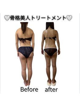 フォルスボーテ(Force Beaute)/【骨格美人トリートメントBA】