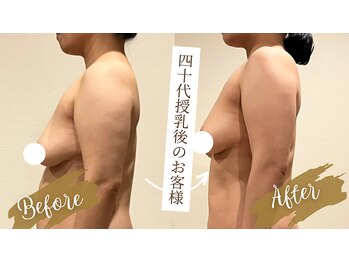サロンハナ(Salon HANA)/授乳後に下がったバストがアップ