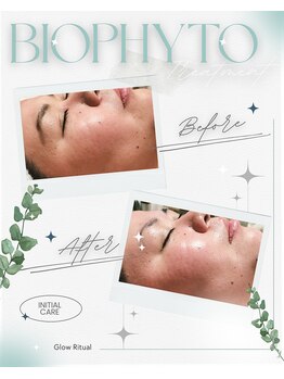 ハレル(Hareru)/Before…After(2)