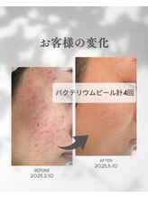 ココフルール(Cocofleur)/お手入れ4回・ホームケア4点