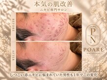 ポアレ(POARE)の雰囲気（男性も多く来店されてます！しっかり変化でて喜ばれてます。）