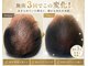 箔屋(hakuya)の写真/男性の育毛を促す!幹細胞の力で力強くサポート!首・デコルテマッサージで極上のリラックス体験を☆