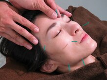 諫早鍼灸院の雰囲気(【小顔美容鍼】一人一人の骨格など見極めオーダーメイド施術)