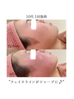 エミ(emi)/大きな顔がコンプレックスでした