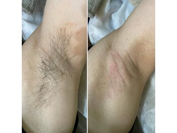 ナチュラヒルズ(Naturahills)/