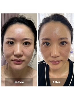 サロン ド アヤ(salon de Aya)/エイジング+小顔