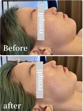 ランプリール 学芸大学(rempli)/最強小顔