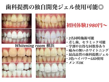 ホワイトニングルーム 横浜店(Whitening Room)