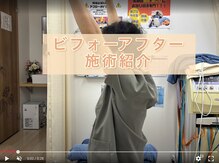 志村三丁目駅前鍼灸院 接骨院/施術の前後を載せております！