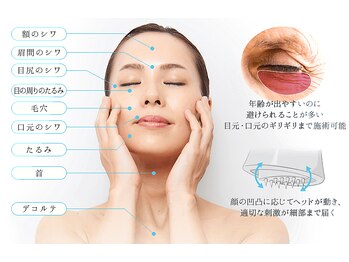 アミューズ なぎさテラス店