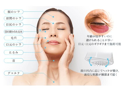 アミューズ なぎさテラス店の写真