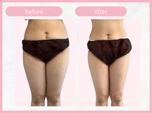 RHB 横浜店/【痩身コース】ビフォーアフター