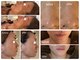 ラブボーテ(LOVE BEAUTE)の写真