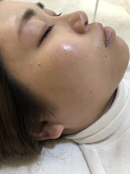 ラソ アイ ビューティー 今治新都市店(lazo eye beauty)/フェイワックス脱毛waxxxx