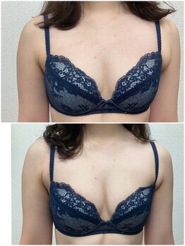 バーディー(BIRDIE)/施術１回/３０代