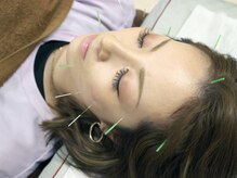 あやのはりきゅう整骨院