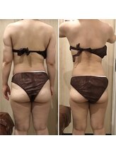 カンフリエ 吉野ヶ里店(Camphrier)/【痩身】ビフォーアフターご紹介