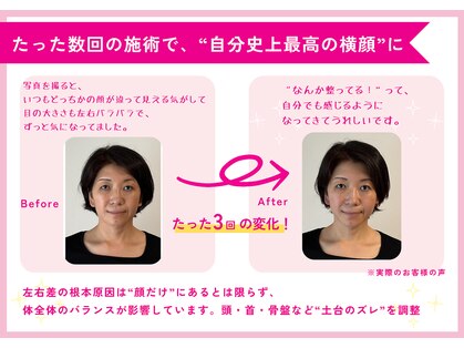 理想の小顔 福島店の写真