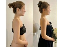 ソウ バイ ソウ(So by 蒼)/何をしてもダメな二の腕劇的改善