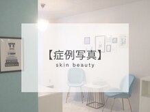 小顔専門店Lift(リフト)渋谷/小顔専門店Lift l 渋谷