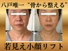【人気No.1】年齢を感じ始めたお顔に◎若見え小顔リフト矯正