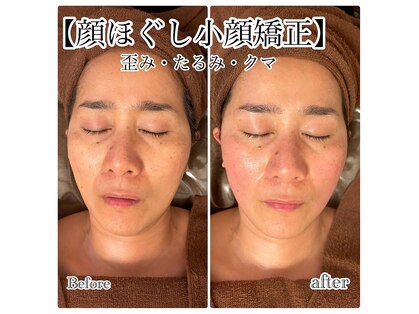 シャラ(shara)の写真