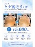《★メンズ脱毛No.1》毎日の髭剃りから卒業!美肌パックヘッドマッサージ付き