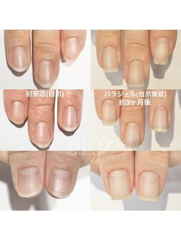 ニコプラス(NICO+)/自爪育成パラジェルクリア補強