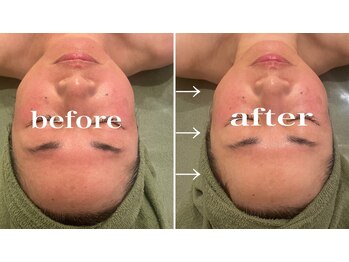 リム(Lim:)/リアボーテ◆レスト