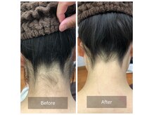 ケースタイル(k.style)の雰囲気（全身脱毛でうなじまでスッキリ！VIO込み♪アップスタイル綺麗☆）