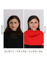 シュアリー(Surely)/トータルコースお客様事例