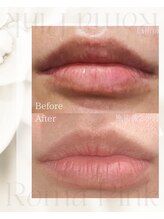 スリーメイ(3mey)/【ローマピンク】リップ症例