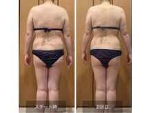 ルリアンデュレ(le lien durer)の雰囲気（上半身施術後。コリを解消することでサイズダウンの様子。）