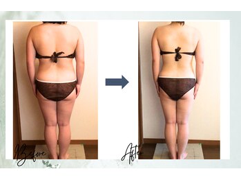 ポノ 茅ヶ崎(Pono.)/セルゼロ4カ月の変化【痩身】