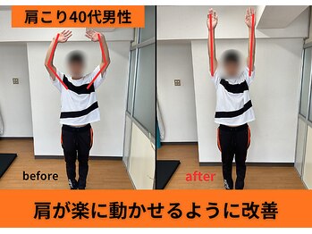 アオ整体院/肩こりのお客様B→A