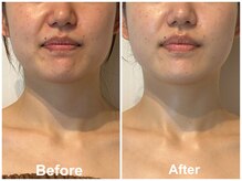 タオ(TAO)/お顔の左右差も整えます。