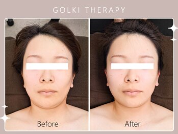 ハノハノ 八代店(HANO HANO)/韓国式小顔コルギ☆