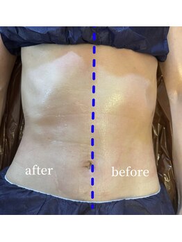 スワロ(suwaro)/お茶蒸しとセットがおすすめ！