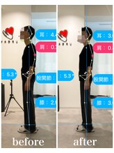 ナオル整体 新宿院(NAORU整体)/50代女性-姿勢矯正3ヶ月経過