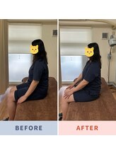 市川本八幡リーフ整骨院/ビフォーアフター/産後骨盤矯正