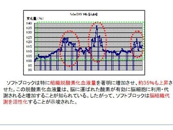 アプロ(APLO)/自律神経調整による脳血流量変化