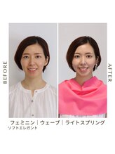 シュアリー(Surely)/トータルコースお客様事例