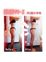 ビューティサロン キヨの部屋(beauty salon)/【筋膜リリース】月１×半年