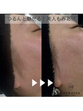 シャイン バンクシア(SHINE Bankusia)/WAX【もみあげ】