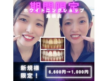 ホワイトニングショップ 島根店