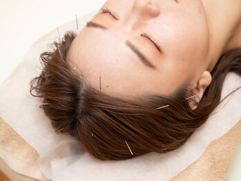 トトノウ(TOTONOU)/眼精疲労にも鍼