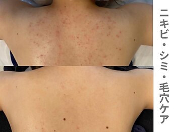 アンシャンテ 神戸元町店(Enchante)/ブライダルエステ神戸元町三ノ宮