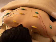 鍼灸師による鍼施術で、慢性首肩こりでお悩みの方はぜひ！