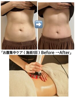 ニテ リンパティック サロン(nite lymphatic salon)/集中ケアで、スッキリボディへ
